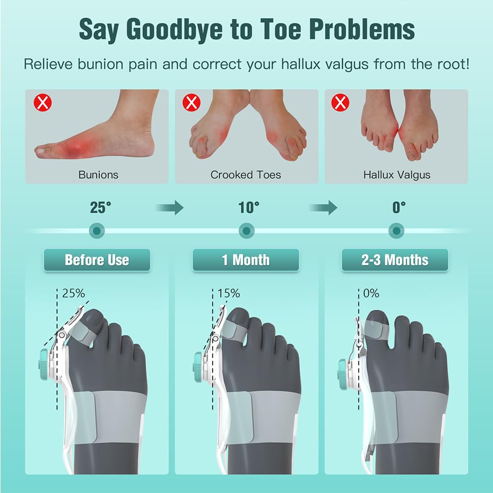 Hallux Valgus Bunion Corrector