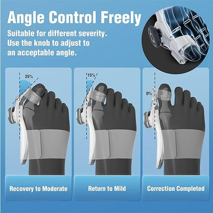 Orthopedic Bunion Corrector