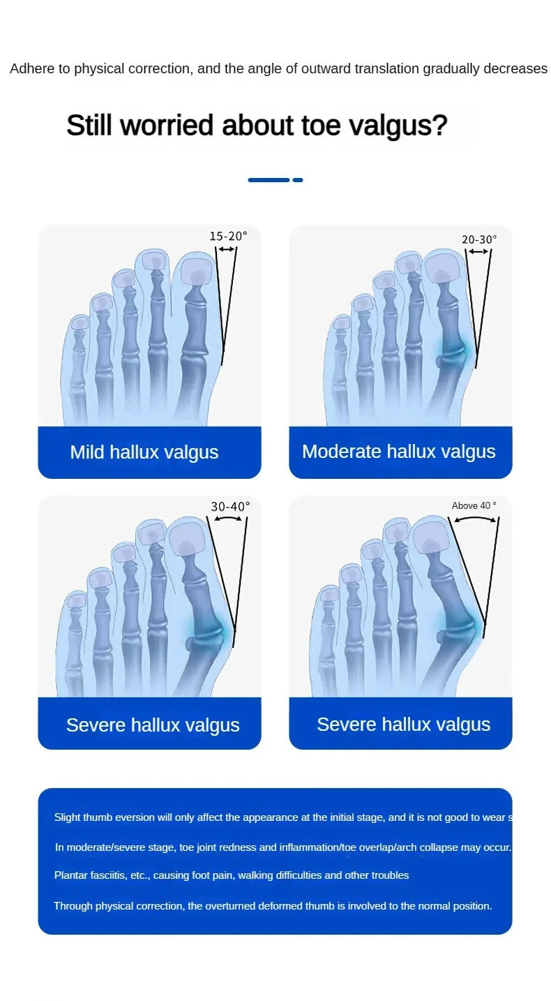 Hallux Valgus Bunion Corrector